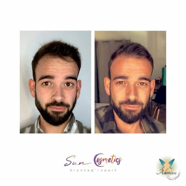 Bronzage sans UV et naturel au centre de bronzage Adonisse