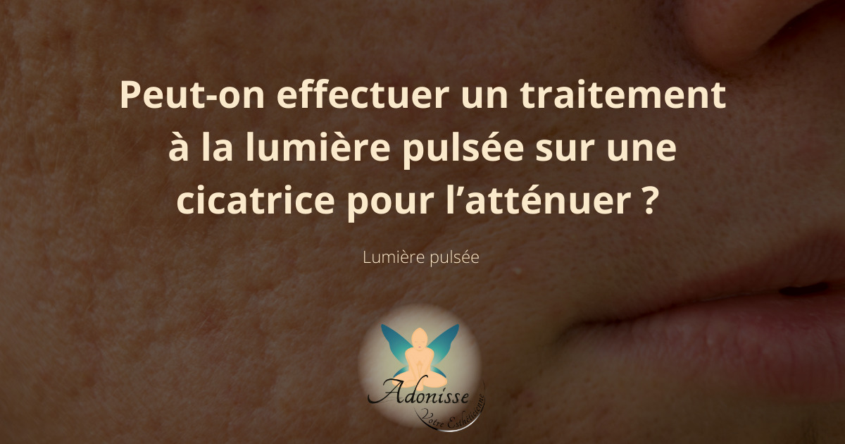 lumiere-pulsee-cicatrices