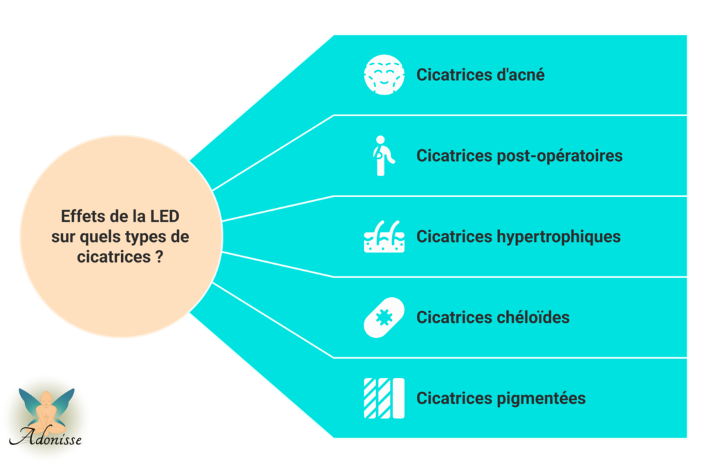 Quels types de cicatrices répondent le mieux à la lumière rouge et infrarouge d'un masque LED ?